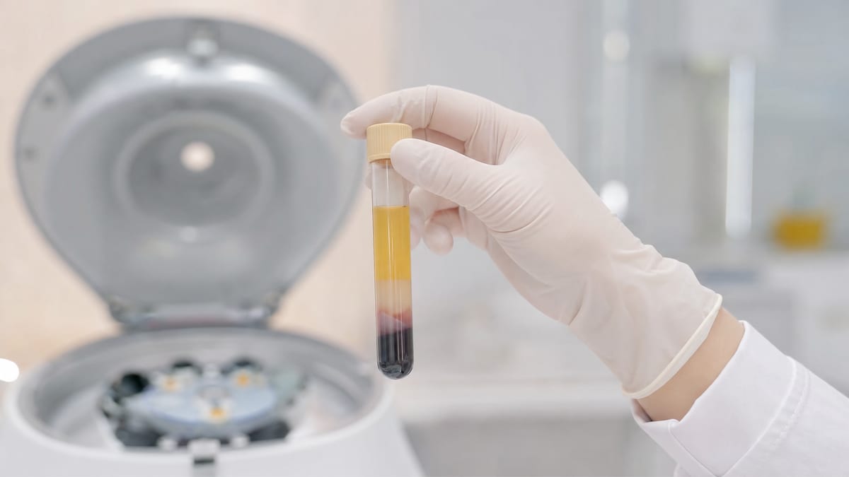 PRP Therapy
